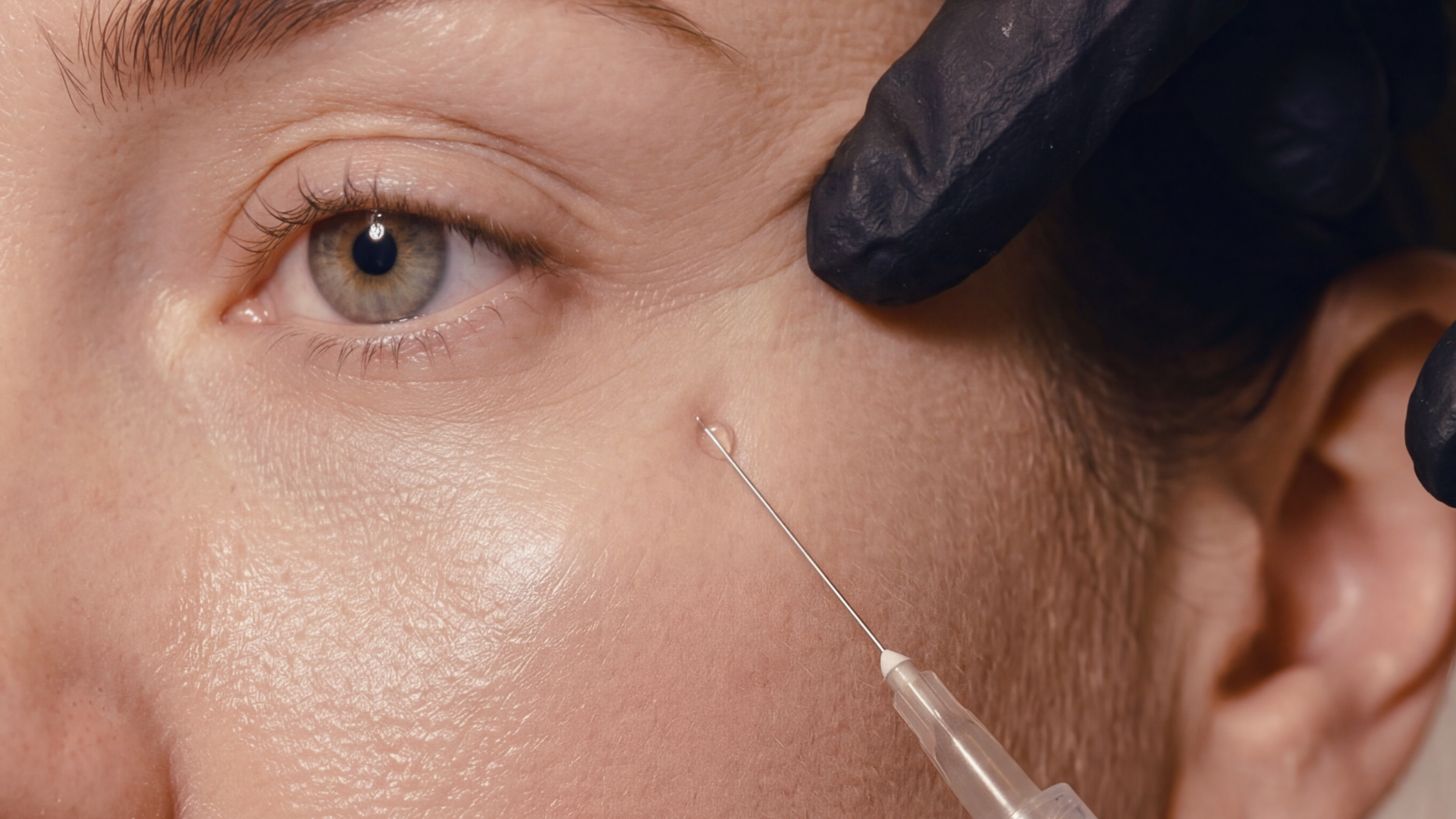 Close up photo of skin showing some wrinkles and a botox needle against the skin