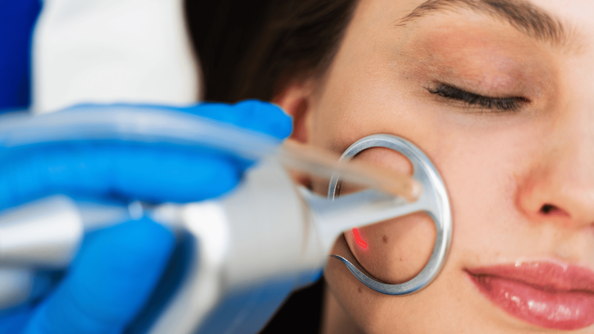 Woman receiving a laser skin treatment on her cheek from a skincare professional.