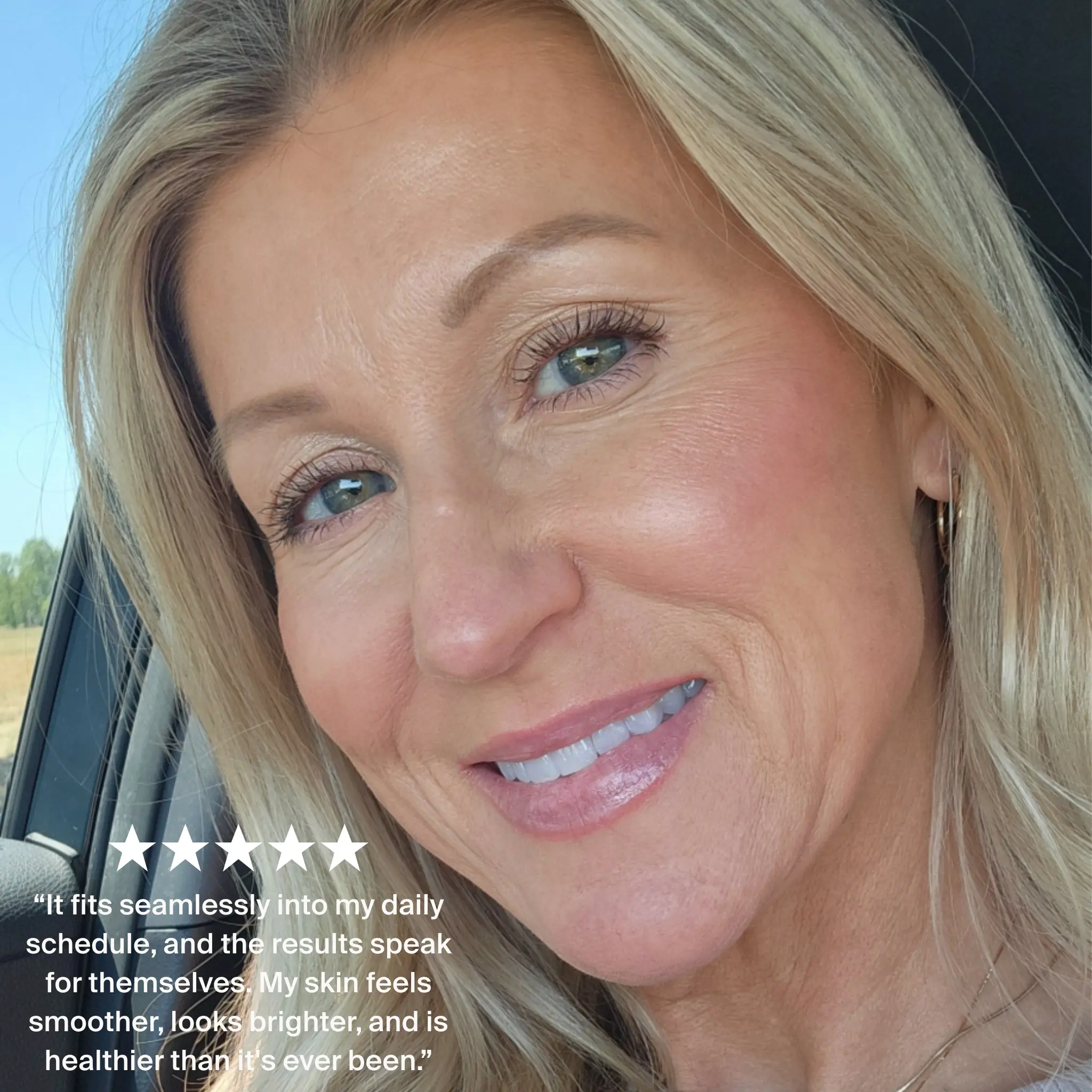 Woman with blonde hair and blue eyes sitting in a car, with text overlay about skincare results.