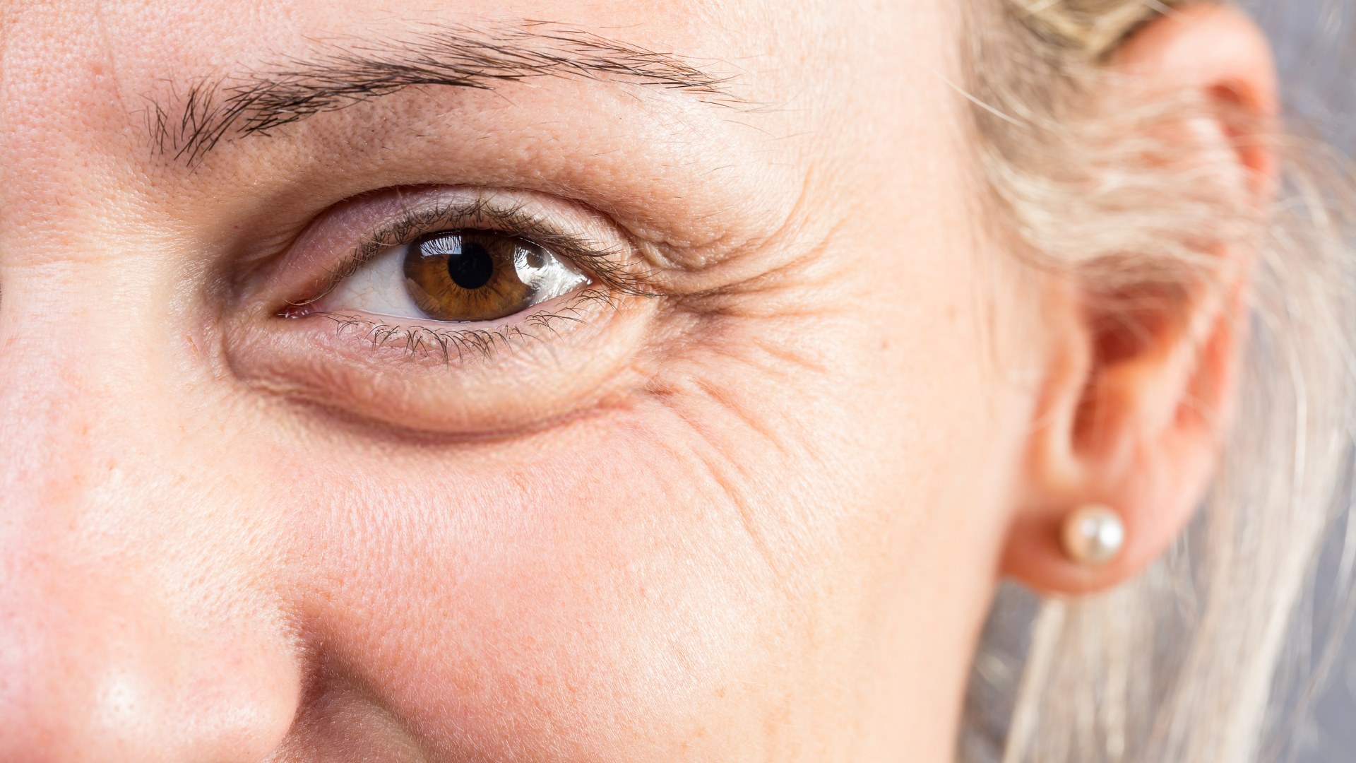tight shot of a single brown eye, with under eye bags and hollowing around the eyes