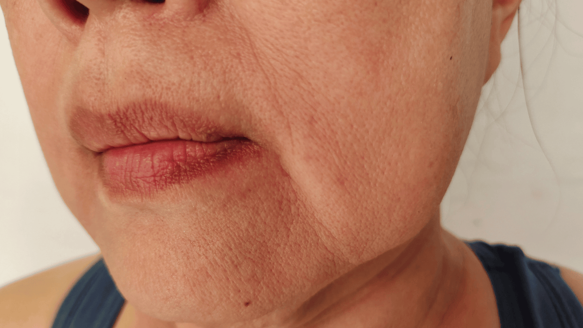 Jowls Explained: What Helps, What Doesn’t, and When to Act